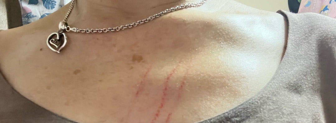 介護の仲間とお花見